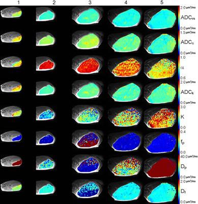 Statistical Evaluation of Different Mathematical Models for Diffusion Weighted Imaging of Prostate Cancer Xenografts in Mice